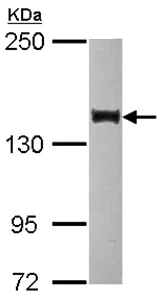 Western blot - Anti-Sin3b antibody (AB101843)