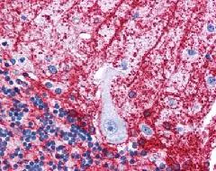 Immunohistochemistry (Formalin/PFA-fixed paraffin-embedded sections) - Anti-SIPA1L3 antibody (AB113657)