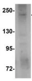Western blot - Anti-SIPA1L3 antibody (AB113657)