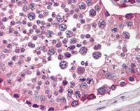 Immunohistochemistry (Formalin/PFA-fixed paraffin-embedded sections) - Anti-SIRP alpha antibody (AB116254)