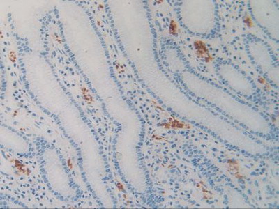 Immunohistochemistry (Formalin/PFA-fixed paraffin-embedded sections) - Anti-SIRP alpha antibody (AB232765), expandable thumbnail