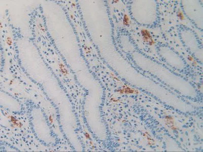 Immunohistochemistry (Formalin/PFA-fixed paraffin-embedded sections) - Anti-SIRP alpha antibody (AB232765)