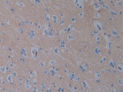 Immunohistochemistry (Formalin/PFA-fixed paraffin-embedded sections) - Anti-SIRP alpha antibody (AB232765), expandable thumbnail