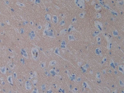 Immunohistochemistry (Formalin/PFA-fixed paraffin-embedded sections) - Anti-SIRP alpha antibody (AB232765)
