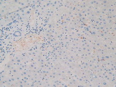 Immunohistochemistry (Formalin/PFA-fixed paraffin-embedded sections) - Anti-SIRP alpha antibody (AB232765), expandable thumbnail
