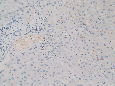 Immunohistochemistry (Formalin/PFA-fixed paraffin-embedded sections) - Anti-SIRP alpha antibody (AB232765)