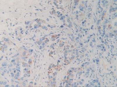 Immunohistochemistry (Formalin/PFA-fixed paraffin-embedded sections) - Anti-SIRP alpha antibody (AB232765), expandable thumbnail