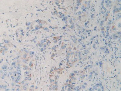 Immunohistochemistry (Formalin/PFA-fixed paraffin-embedded sections) - Anti-SIRP alpha antibody (AB232765)