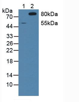 Western blot - Anti-SIRP alpha antibody (AB232765), expandable thumbnail