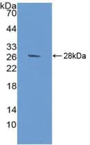 Western blot - Anti-SIRP alpha antibody (AB232765)