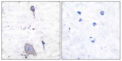 Immunohistochemistry (Formalin/PFA-fixed paraffin-embedded sections) - Anti-SIRP alpha antibody (AB53721)