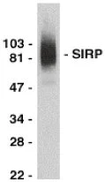 Western blot - Anti-SIRP alpha antibody (AB8120)