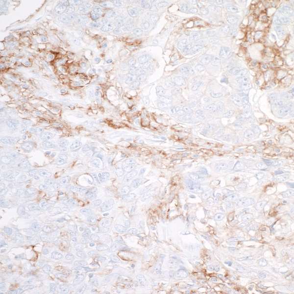 Immunohistochemistry (Formalin/PFA-fixed paraffin-embedded sections) - Anti-SIRP alpha antibody [BLR049F] - BSA free (AB314072), expandable thumbnail