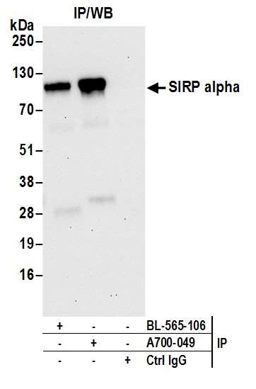 Immunoprecipitation - Anti-SIRP alpha antibody [BLR049F] - BSA free (AB314072), expandable thumbnail
