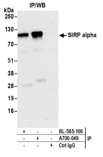 Immunoprecipitation - Anti-SIRP alpha antibody [BLR049F] - BSA free (AB314072)