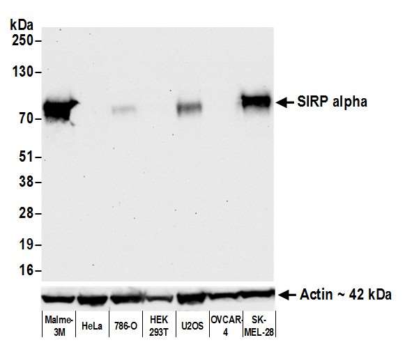 Western blot - Anti-SIRP alpha antibody [BLR049F] - BSA free (AB314072), expandable thumbnail