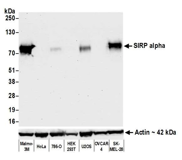 Western blot - Anti-SIRP alpha antibody [BLR049F] - BSA free (AB314072)