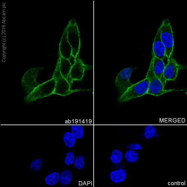 Immunocytochemistry/ Immunofluorescence - Anti-SIRP alpha antibody [EPR16264] (AB191419)
