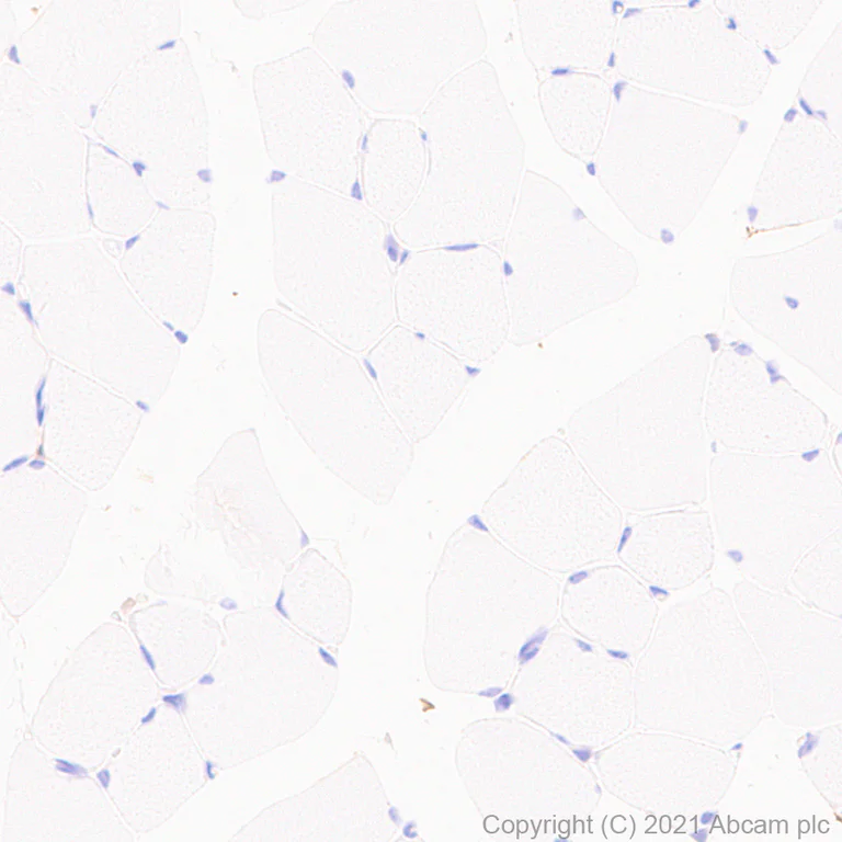 Immunohistochemistry (Formalin/PFA-fixed paraffin-embedded sections) - Anti-SIRP alpha antibody [EPR24187-17] (AB259357)