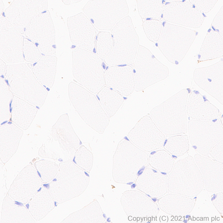 Immunohistochemistry (Formalin/PFA-fixed paraffin-embedded sections) - Anti-SIRP alpha antibody [EPR24187-17] - BSA and Azide free (AB288445), expandable thumbnail