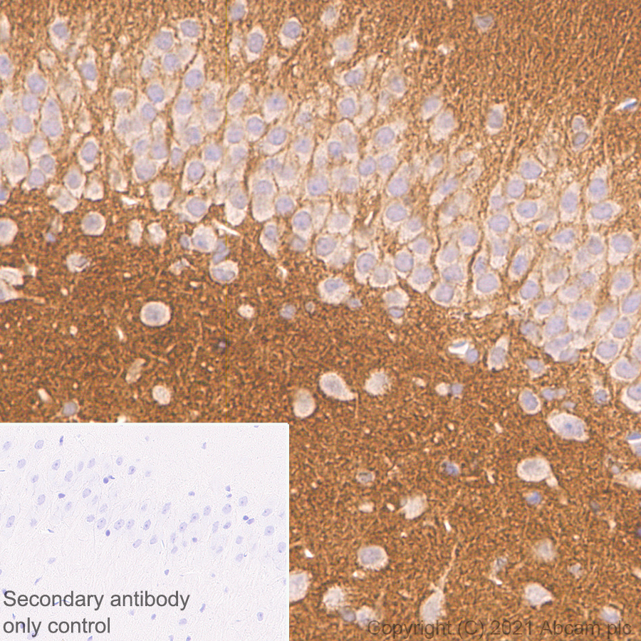 Immunohistochemistry (Formalin/PFA-fixed paraffin-embedded sections) - Anti-SIRP alpha antibody [EPR24187-17] - BSA and Azide free (ab288445), expandable thumbnail