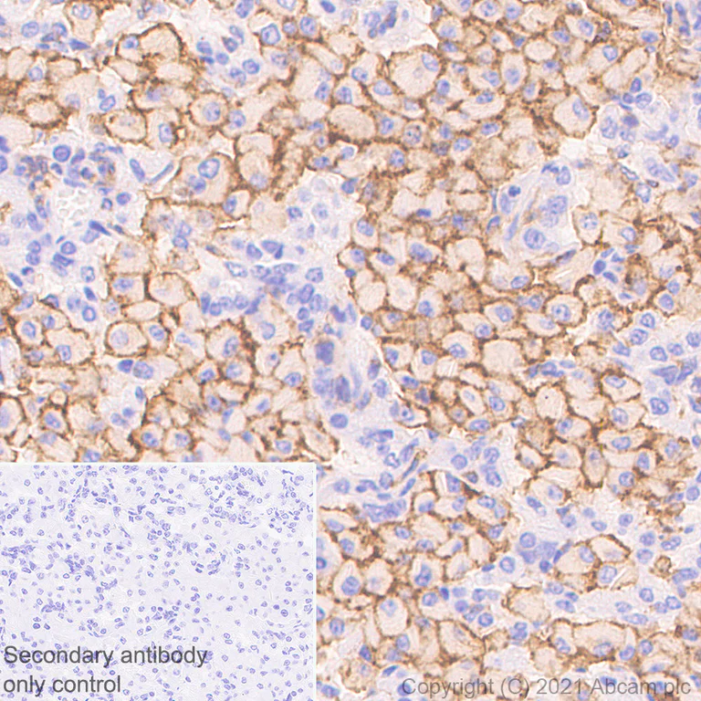 Immunohistochemistry (Formalin/PFA-fixed paraffin-embedded sections) - Anti-SIRP alpha antibody [EPR24187-17] - BSA and Azide free (AB288445)