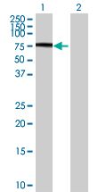 Western blot - SIRP alpha overexpression 293T lysate (whole cell) (AB94139), expandable thumbnail