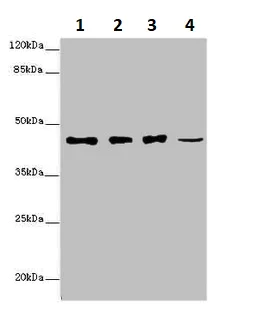 Western blot - Anti-SIRPB1 antibody (AB234681)