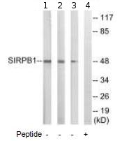 Western blot - Anti-SIRPB1 antibody (AB92732)