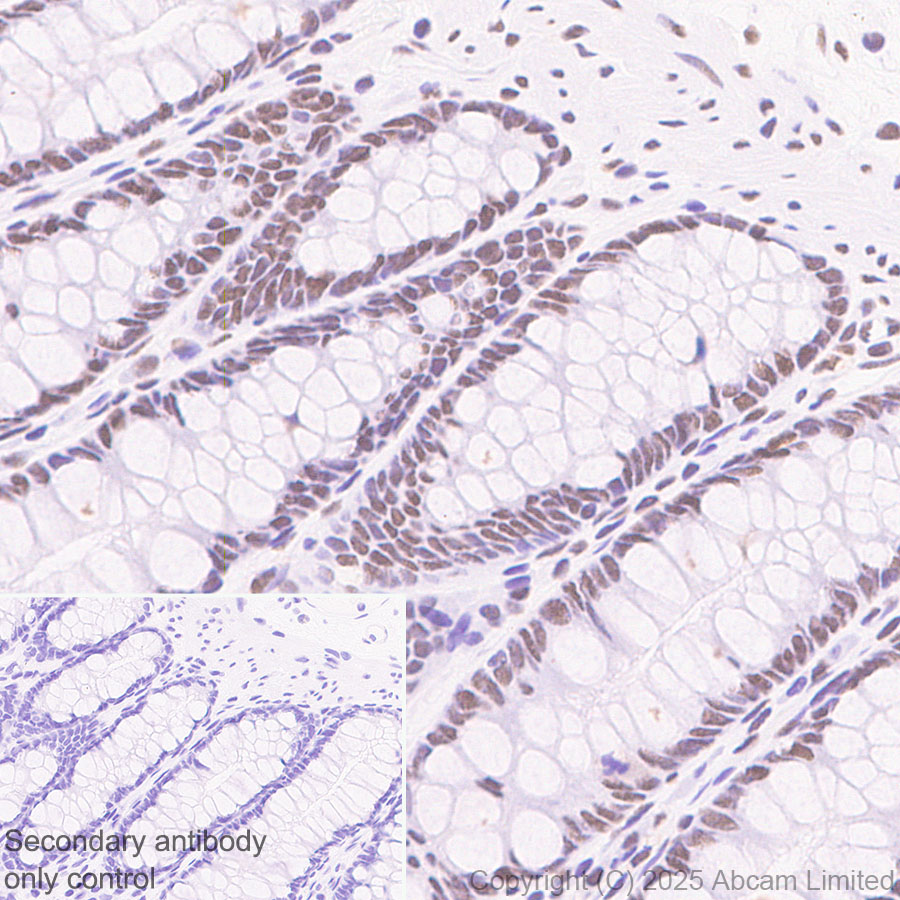 Immunohistochemistry (Formalin/PFA-fixed paraffin-embedded sections) - Anti-SIRT1 antibody [19A7AB4] (ab110304), expandable thumbnail