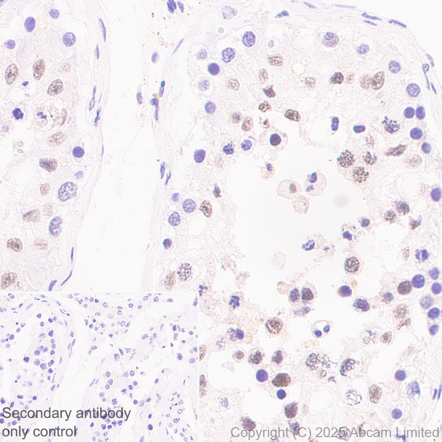 Immunohistochemistry (Formalin/PFA-fixed paraffin-embedded sections) - Anti-SIRT1 antibody [19A7AB4] (ab110304), expandable thumbnail