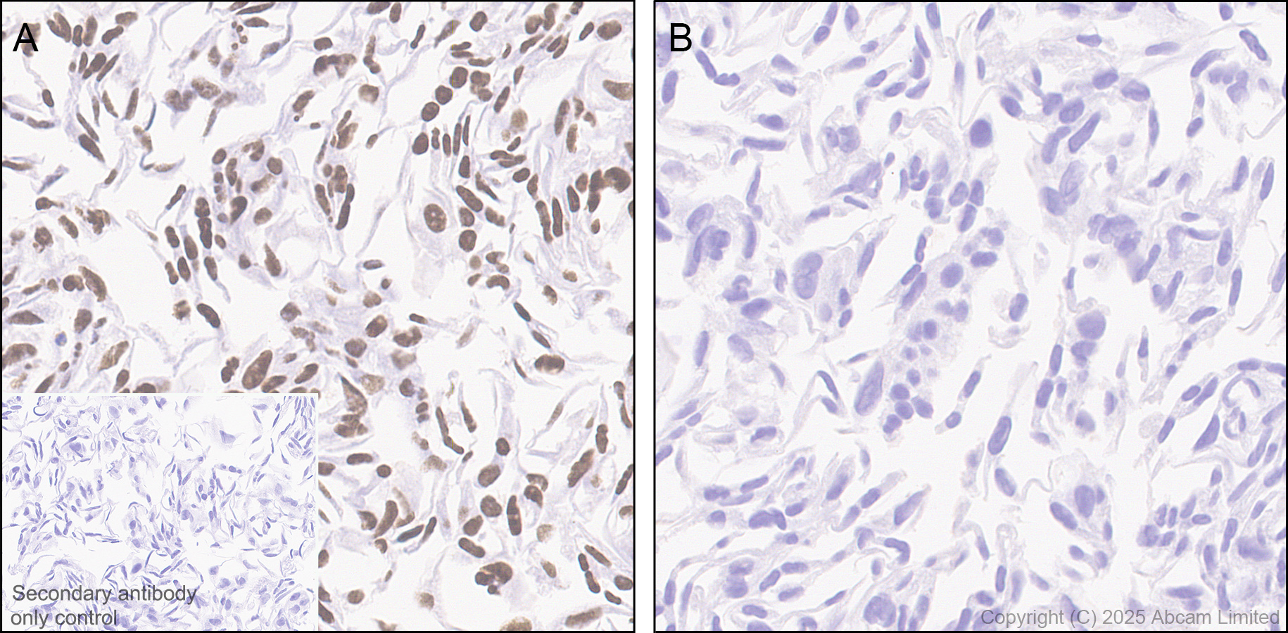 Immunohistochemistry (Formalin/PFA-fixed paraffin-embedded sections) - Anti-SIRT1 antibody [19A7AB4] (ab110304), expandable thumbnail
