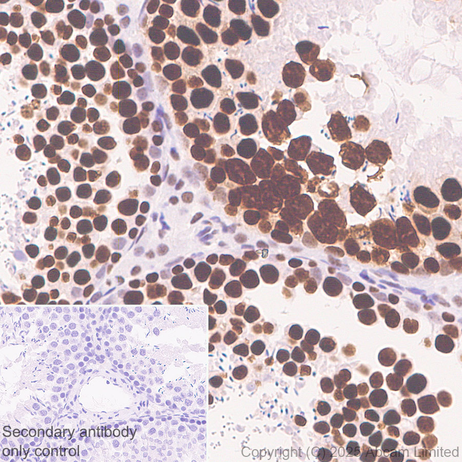 Immunohistochemistry (Formalin/PFA-fixed paraffin-embedded sections) - Anti-SIRT1 antibody [19A7AB4] (ab110304), expandable thumbnail