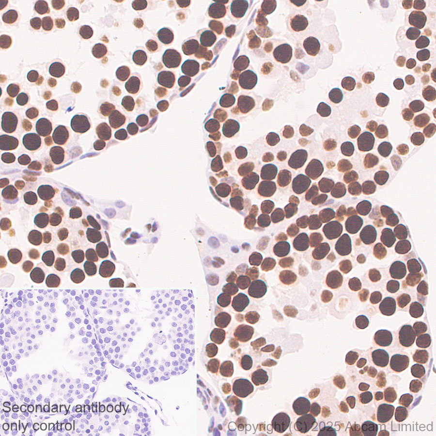 Immunohistochemistry (Formalin/PFA-fixed paraffin-embedded sections) - Anti-SIRT1 antibody [19A7AB4] (ab110304), expandable thumbnail