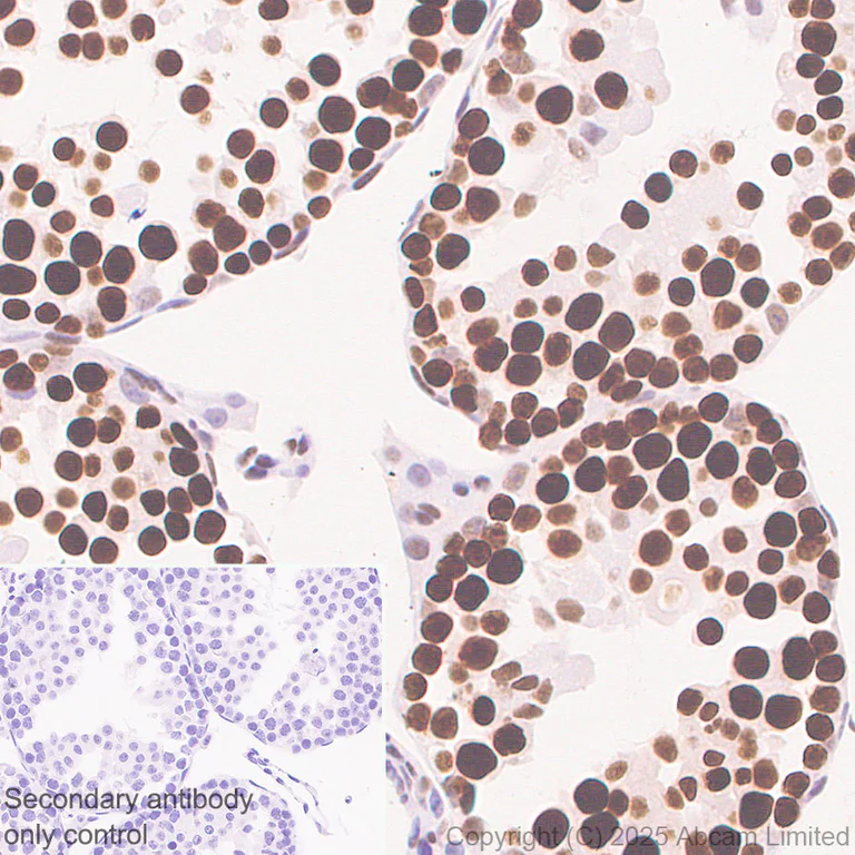 Immunohistochemistry (Formalin/PFA-fixed paraffin-embedded sections) - Anti-SIRT1 antibody [19A7AB4] (AB110304)