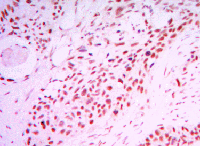 Immunohistochemistry (Formalin/PFA-fixed paraffin-embedded sections) - Anti-SIRT1 antibody [1F3] - Nuclear Marker (AB104833), expandable thumbnail