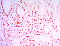 Immunohistochemistry (Formalin/PFA-fixed paraffin-embedded sections) - Anti-SIRT1 antibody [1F3] - Nuclear Marker (AB104833), expandable thumbnail
