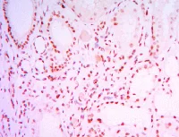 Immunohistochemistry (Formalin/PFA-fixed paraffin-embedded sections) - Anti-SIRT1 antibody [1F3] - Nuclear Marker (AB104833)