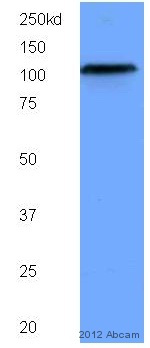 Western blot - Anti-SIRT1 antibody [1F3] - Nuclear Marker (ab104833), expandable thumbnail