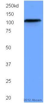 Western blot - Anti-SIRT1 antibody [1F3] - Nuclear Marker (AB104833)