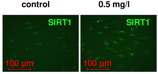 Immunocytochemistry/ Immunofluorescence - Anti-SIRT1 antibody (AB12193)
