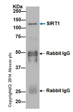 Immunoprecipitation - Anti-SIRT1 antibody [E104] (AB32441)
