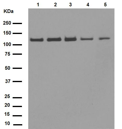 Western blot - Anti-SIRT1 antibody [E104] (AB32441)