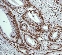 Immunohistochemistry (Formalin/PFA-fixed paraffin-embedded sections) - Anti-SIRT1 antibody [E104] - BSA and Azide free (AB220807)