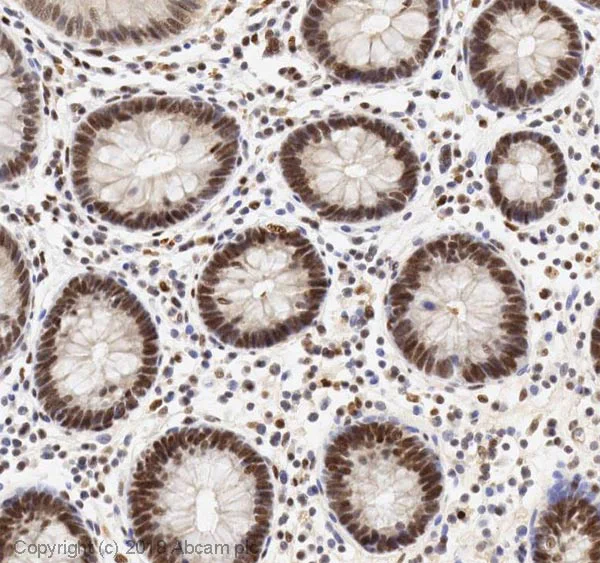 Immunohistochemistry (Formalin/PFA-fixed paraffin-embedded sections) - Anti-SIRT1 antibody [E104] - BSA and Azide free (AB220807)