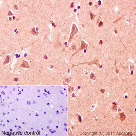 Immunohistochemistry (Formalin/PFA-fixed paraffin-embedded sections) - Anti-SIRT1 antibody [E104] - BSA and Azide free (AB220807)