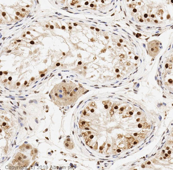 Immunohistochemistry (Formalin/PFA-fixed paraffin-embedded sections) - Anti-SIRT1 antibody [E104] - BSA and Azide free (AB220807)