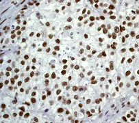 Immunohistochemistry (Formalin/PFA-fixed paraffin-embedded sections) - Anti-SIRT1 antibody [E104] - BSA and Azide free (AB220807)