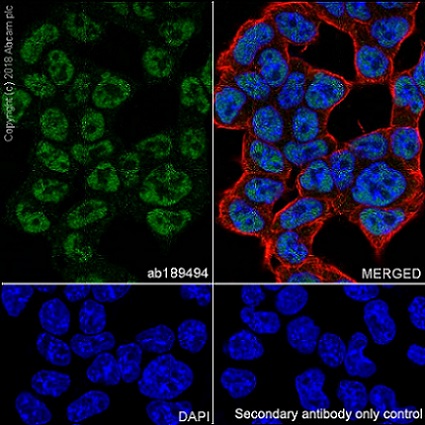 Immunocytochemistry/ Immunofluorescence - Anti-SIRT1 antibody [EPR18239] (AB189494), expandable thumbnail