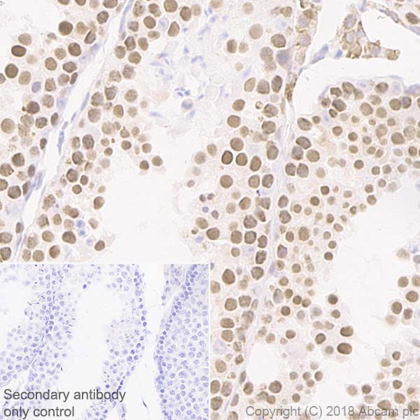 Immunohistochemistry (Formalin/PFA-fixed paraffin-embedded sections) - Anti-SIRT1 antibody [EPR18239] (ab189494), expandable thumbnail